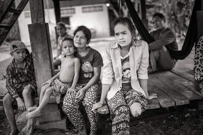 MAG cambodia village landmine victim